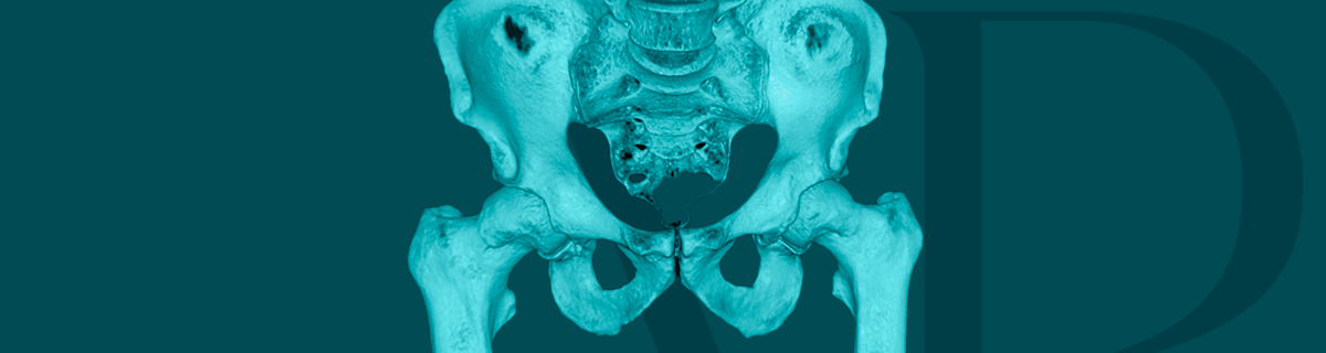 imagem-impacto-femoroacetabular-vitor-pedrozo